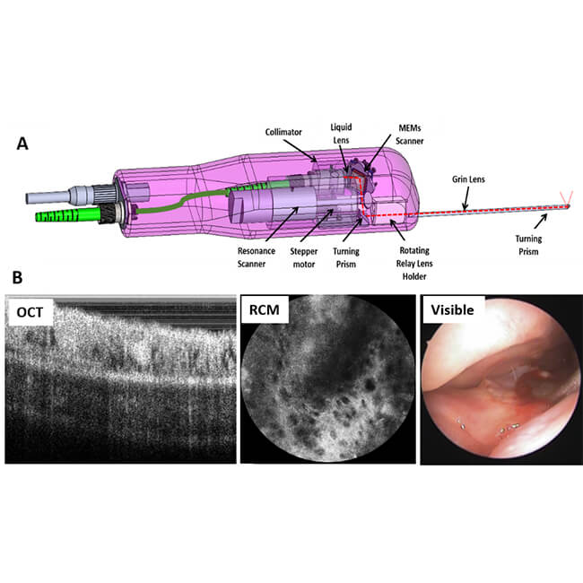 Schematic of OCT/RCM endoscopic probe (A), and OCT, RCM and visible nasoendoscopic images (B).