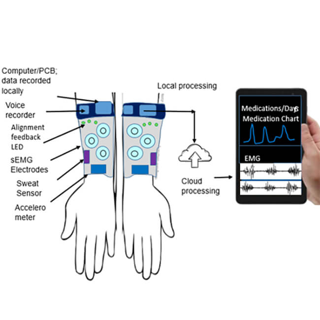 Arm sleeve real time monitoring device for PD patients.