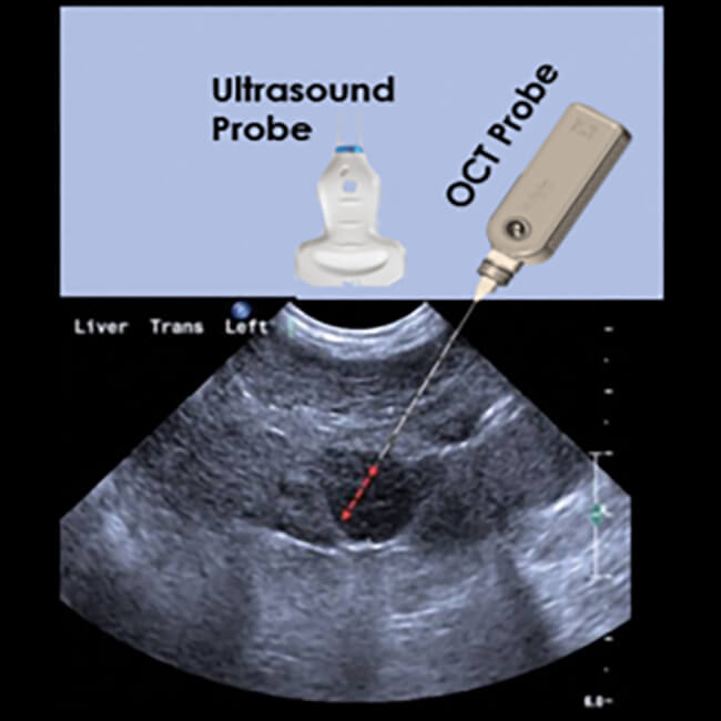 Left: tVisio use in coordination with Ultra-Sound (US) imaging; Right: Examples of tissue scanned images -Arrows indicate fibrosis